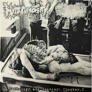 FLAC Hyperviscosity / Blenncardichromodacryexgenitohaemgene - Pathology And Anatomy: Chapter. 1