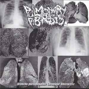 FLAC Pulmonary Fibrosis / Agathocles - Broncho-pneumopathie Chronique Obstructive / Suppository Of Speed