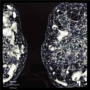 FLAC Fescal - Paralysis