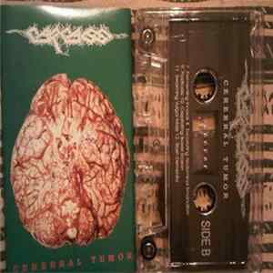 FLAC Carcass - Cerebral Tumor