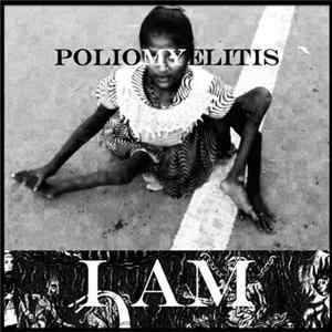 FLAC poliomyelitis - I Am Deluxe