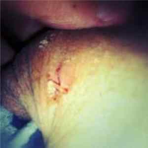 FLAC To The Lovers, Farewell - Vasectomy Vasect 2 You