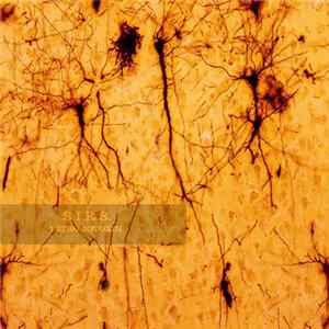 FLAC Systemic Inflammatory Response Syndrome - Tetrodotoxin Single 2017