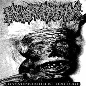 FLAC Neuropathy - Dysmenorrheic Torture