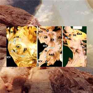FLAC Imaginary Forces - Metonym